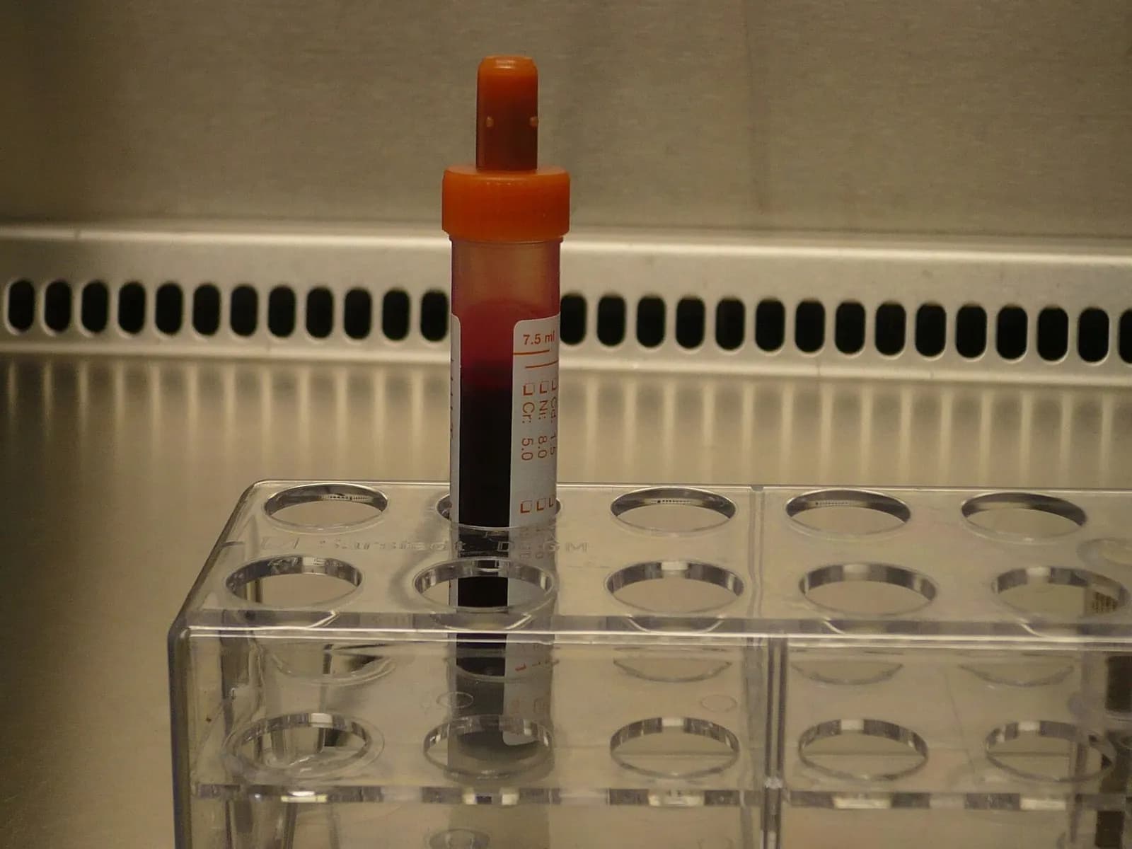A capped blood collection tube with a label standing in a clear plastic test-tube rack in a laboratory